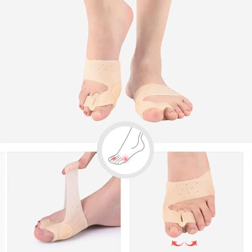 Bunion Corrector for Runners