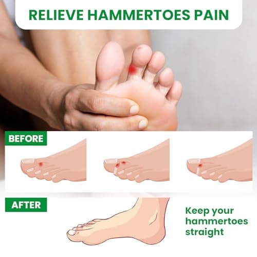 Bukihome Hammer Toe Straightener - 6-Pack Toe Splints for Men and Women