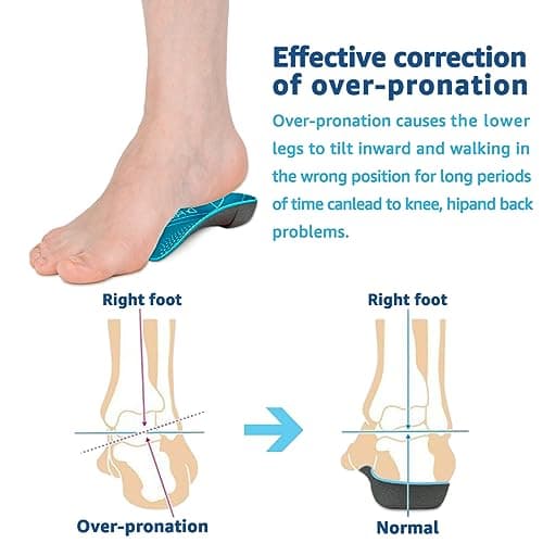 High Arch Support 3/4 Orthotic Insoles for Plantar Fasciitis and Heel Pain (X-Large)