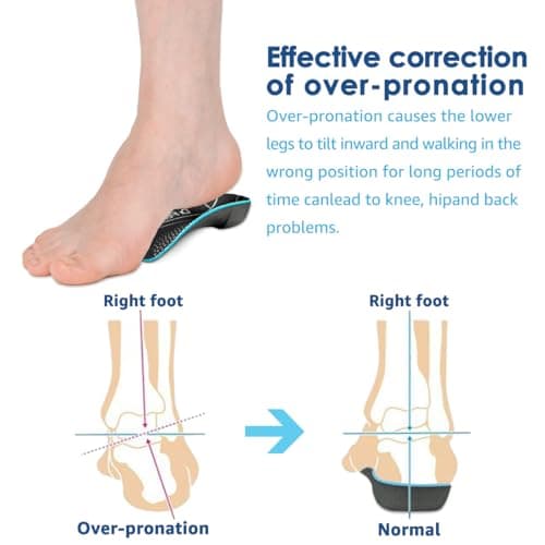 High Arch Plantar Fasciitis Insoles for Over-Pronation and Foot Pain (Medium)