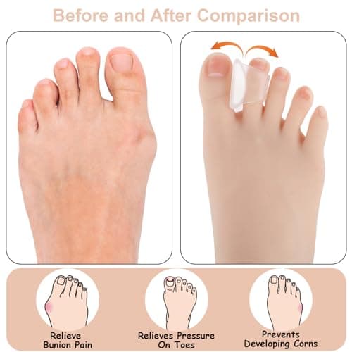 Toe Straighteners for Hammer Toes - Gel Separators for Women - 3 Sizes