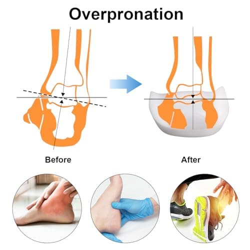3/4 Arch Support Orthotics Relieve Plantar Fasciitis & Foot Pain (White, Men 6-8.5/Women 8-10.5)