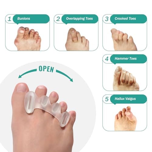 Welnove Adjustable Toe Separators - Relieve Pain, Correct Bunions & Hammertoes (2 Pairs, Gift Box)