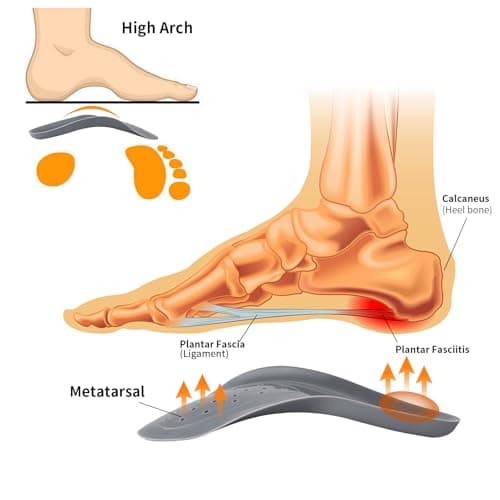 3/4 Arch Support Orthotics Relieve Plantar Fasciitis, Foot Pain (Gray, Men 9-12/Women 11-14)