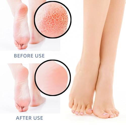 4 Pair Silicone Heel Protectors for Cracked Heels, Plantar Fasciitis Inserts