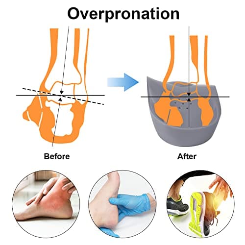 High Arch Inserts for Plantar Fasciitis - Firm Orthotics, Heel Pain Relief