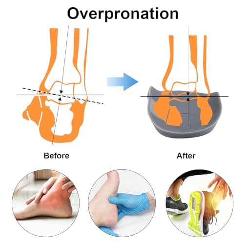 3/4 Arch Support Orthotics Relieve Plantar Fasciitis, Foot Pain (Gray, Men 9-12/Women 11-14)