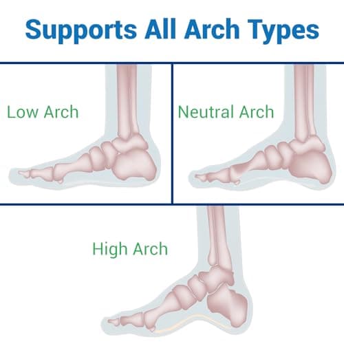 VIVEsole 3/4 Insoles for Flat Feet, Arch Support - Pain Relief for Plantar Fasciitis, Fatigue, and Back Pain