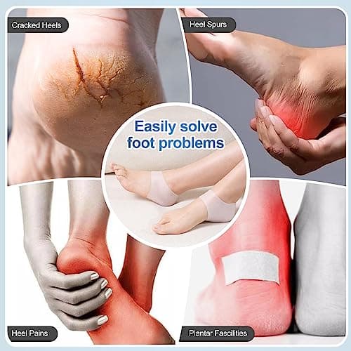Blue and White Silicone Heel Cups for Foot Pain, Cracked Heels & Support
