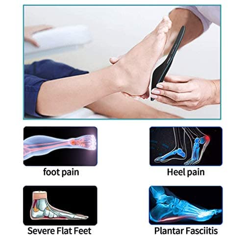 Severe Flat Feet Arch Support Insoles for Plantar Fasciitis, Over Pronation & Foot Pain
