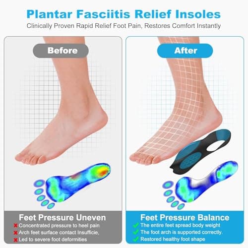 Plantar Fasciitis Relief Arch Supports for Flat Feet, X/O Leg Correction, Comfortable Foot Care