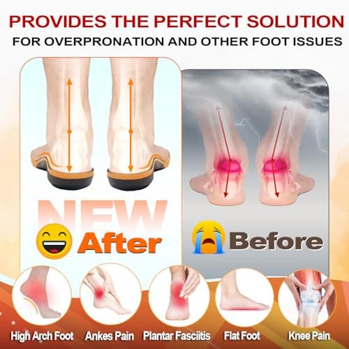 High-Arch Support Orthotic Insoles for Plantar Fasciitis, Knee Pain, and Flat Feet - Cloud Step Comfort Gel Insoles